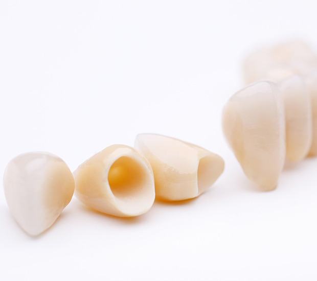 Dawsonville Dental Crowns and Dental Bridges