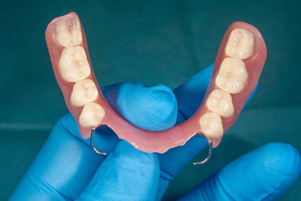 A Dentist Explains Why Partial Dentures Might Be Right For You