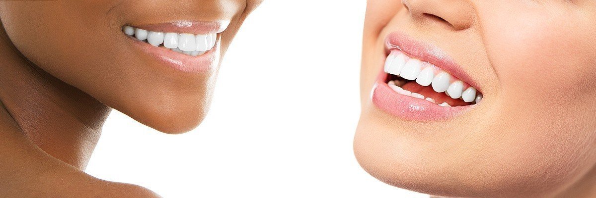 Dawsonville Dental Restoration